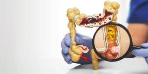 Bağırsak sağlığını tehdit eden 5 besin grubu