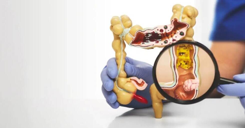 Bağırsak sağlığını tehdit eden 5 besin grubu